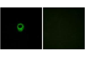 Immunofluorescence analysis of MCF7 cells, using EDG4 Antibody. (EDG4 抗体  (AA 271-320))
