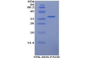 SDS-PAGE analysis of Rabbit Tissue Factor Protein. (Tissue factor 蛋白)