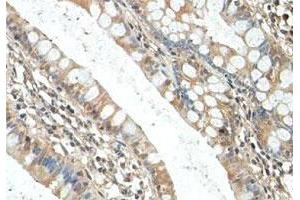 Immunohistochemical staining of formalin-fixed paraffin-embedded human fetal small intestine tissue showing cytoplasmic staining with RICTOR polyclonal antibody  at 1 : 100 dilution. (RICTOR 抗体  (AA 1406-1700))