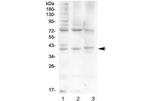 Western blot testing of human 1) HeLa, 2) HepG2 and 3) A431 cell lysate with HFE antibody at 0. (HFE 抗体)