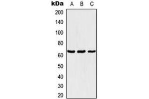 Western blot analysis of TBX18 expression in Jurkat (A), NIH3T3 (B), PC12 (C) whole cell lysates.