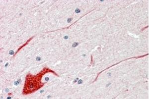 Immunohistochemistry (IHC) image for anti-Protein tyrosine Phosphatase, Non-Receptor Type 11 (PTPN11) (C-Term) antibody (ABIN184604)