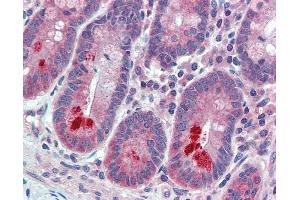 Immunohistochemistry (IHC) image for anti-Extended Synaptotagmin-Like Protein 1 (ESYT1) (Internal Region) antibody (ABIN1048589)