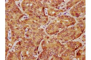 Immunohistochemistry (IHC) image for anti-LATS, Large Tumor Suppressor, Homolog 1 (Drosophila) (LATS1) (AA 1-280) antibody (ABIN7169059)