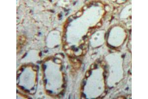 Used in DAB staining on fromalin fixed paraffin-embedded kidney tissue (C1QBP 抗体  (AA 72-279))