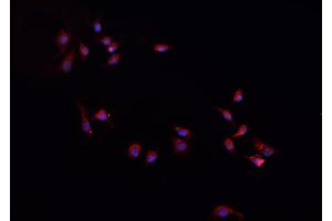 ABIN6268949 staining A-431 cells by IF/ICC. (CXCL1 抗体  (Internal Region))
