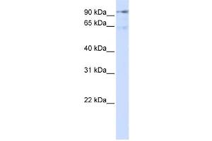 Western Blotting (WB) image for anti-Discs, Large (Drosophila) Homolog-Associated Protein 5 (DLGAP5) antibody (ABIN2458993) (DLGAP5 抗体)