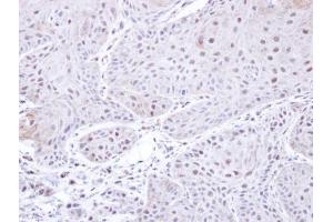 IHC-P Image Immunohistochemical analysis of paraffin-embedded Cal27 xenograft , using PSMC3, antibody at 1:500 dilution. (PSMC3 抗体)