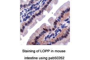 Image no. 2 for anti-Lysyl Oxidase Pro-Peptide (LOPP) (AA 78-115), (Internal Region) antibody (ABIN363571)
