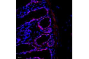 Immunofluorescence (Paraffin-embedded Sections) (IF (p)) image for anti-Prothymosin, alpha (PTMA) antibody (ABIN7075306)