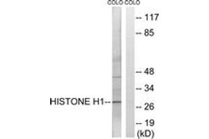 Western blot analysis of extracts from COLO cells, using Histone H1 (Ab-17) Antibody. (Histone H1 抗体  (AA 1-50))
