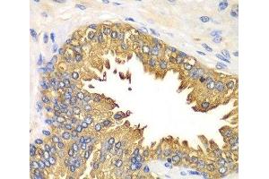 Immunohistochemistry of paraffin-embedded Human prostate using RIG-I / DDX58 Polyclonal Antibody at dilution of 1:100 (40x lens). (DDX58 抗体)