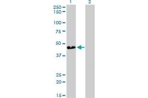 Western Blotting (WB) image for anti-ATPase, H+ Transporting, Lysosomal 38kDa, V0 Subunit D1 (ATP6V0D1) (AA 238-308) antibody (ABIN563945)