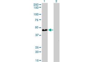 Western Blot analysis of ATP6V0D1 expression in transfected 293T cell line by ATP6V0D1 monoclonal antibody (M01), clone 2G12. (ATP6V0D1 抗体  (AA 238-308))