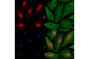 ABIN6263188 and ABIN6279524 staining  cells by IF/ICC. (MED11 抗体  (Internal Region))