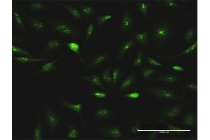 Immunofluorescence of purified MaxPab antibody to ESF1 on HeLa cell.