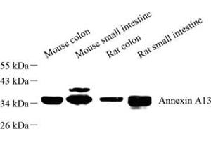 Western blot analysis of Annexin-A13 (ABIN7073062) at dilution of 1: 500 (Annexin A13 抗体)