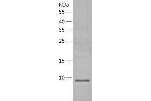 Western Blotting (WB) image for Secretory Leukocyte Peptidase Inhibitor (SLPI) (AA 26-132) protein (His-IF2DI Tag) (ABIN7125010)