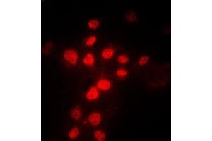 Immunofluorescent analysis of MLH1 staining in HeLa cells. (MLH1 抗体  (Center))