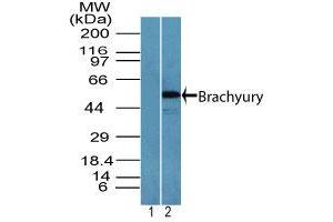 Image no. 2 for anti-T Brachyury Protein (AA 350-400) antibody (ABIN960367) (T Brachyury Protein (AA 350-400) 抗体)