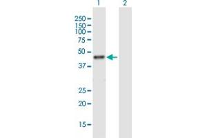 Western Blot analysis of RRM2 expression in transfected 293T cell line ( H00006241-T01 ) by RRM2 MaxPab polyclonal antibody. (RRM2 抗体  (AA 1-389))