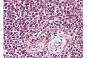Human Spleen (formalin-fixed, paraffin-embedded) stained with APAF1at 10 µg/ml followed by biotinylated goat anti-rabbit IgG secondary antibody, alkaline phosphatase-streptavidin and chromogen. (APAF1 抗体  (C-Term))