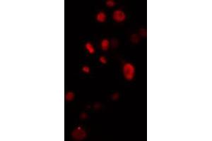 ABIN6274504 staining Hela cells by IF/ICC. (ZNF541 抗体  (Internal Region))