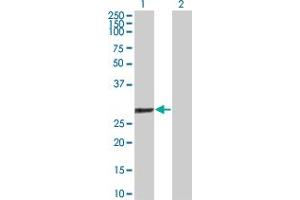 Western Blot analysis of GSTO1 expression in transfected 293T cell line by GSTO1 polyclonal antibody (A01). (GSTO1 抗体  (AA 121-209))