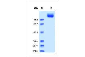 Human VEGF R2, His Tag (HPLC-verified) on SDS-PAGE under reducing (R) condition.