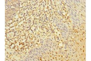 Immunohistochemistry of paraffin-embedded human tonsil tissue using ABIN7167590 at dilution of 1:100 (RGS1 抗体  (AA 1-181))