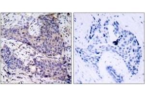 Immunohistochemistry (IHC) image for anti-BCL2-Associated Agonist of Cell Death (BAD) (AA 102-151) antibody (ABIN2888955) (BAD 抗体  (AA 102-151))