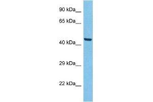 Host:  Rabbit  Target Name:  ACHB3  Sample Type:  A549 Whole Cell lysates  Antibody Dilution:  1.