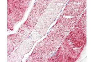Human, Skeletal muscle: Formalin-Fixed Paraffin-Embedded (FFPE). (XYLT2 抗体  (AA 722-771))