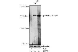 Western blot analysis of extracts of Jurkat cells, using Phospho-MK5-S967 antibody (ABIN7268655) at 1:1000 dilution. (ASK1 抗体  (pSer967))