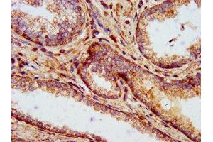 Immunohistochemistry (IHC) image for anti-ClpP Caseinolytic Peptidase, ATP-Dependent, Proteolytic Subunit Homolog (E. Coli) (CLPP) (AA 223-277) antibody (ABIN7144958)