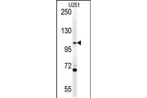 Western blot analysis of ACAP3 Antibody in U251 cell line lysates (35ug/lane) (Acap3 抗体  (N-Term))