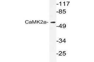 Western blot (WB) analyzes of CaMK2-a antibody in extracts from A431 cells. (CAMK2A 抗体)