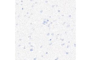 Immunohistochemistry of paraffin-embedded Human brain (negative control sample) using CD7 antibody (ABIN7266214) at dilution of 1:10000 (40x lens). (CD7 抗体)