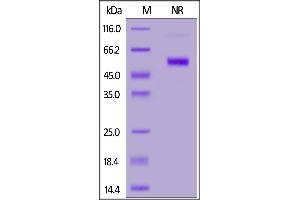 SDS-PAGE (SDS) image for CD70 Molecule (CD70) (AA 52-193) (Active) protein (His tag,DYKDDDDK Tag,FITC) (ABIN6972978)