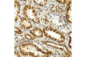 Immunohistochemistry of paraffin-embedded human kidney using SMAD9 antibody (ABIN5975592) at dilution of 1/100 (40x lens). (SMAD9 抗体)