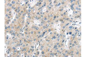 Immunohistochemistry (IHC) image for anti-Vacuolar Protein Sorting-Associated Protein 26A (VPS26A) antibody (ABIN5959956) (VPS26A 抗体)