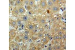 IHC-P analysis of Liver tissue, with DAB staining. (PCSK9 抗体  (AA 156-461))