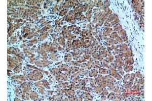 Immunohistochemistry (IHC) analysis of paraffin-embedded Human Pancreas, antibody was diluted at 1:100. (CXCR6 抗体  (N-Term))