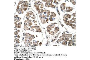 Rabbit Anti-ACTN2 Antibody  Paraffin Embedded Tissue: Human Muscle Cellular Data: Skeletal muscle cells Antibody Concentration: 4. (ACTN2 抗体  (C-Term))