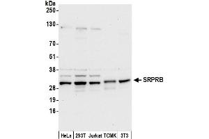 Western Blotting (WB) image for anti-Signal Recognition Particle Receptor, B Subunit (SRPRB) (AA 200-250) antibody (ABIN7449829)