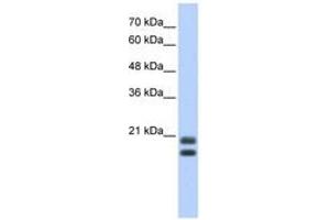 Image no. 1 for anti-serglycin (SRGN) (AA 71-120) antibody (ABIN6742973) (SRGN 抗体  (AA 71-120))
