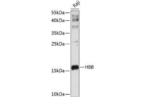 Western blot analysis of extracts of Raji cells, using HBB antibody (ABIN6133523, ABIN6141639, ABIN6141641 and ABIN6217257) at 1:1000 dilution. (Hemoglobin Subunit beta 抗体  (AA 1-147))
