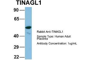 Host: Rabbit Target Name: CHAD Sample Type: Human Adult Placenta Antibody Dilution: 1. (TINAGL1 抗体  (Middle Region))
