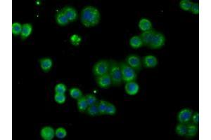 Image no. 2 for anti-Acetyl-CoA Acetyltransferase 2 (ACAT2) antibody (ABIN1496399) (ACAT2 抗体)