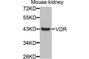 Western blot analysis of extracts of mouse kidney cells, using VDR antibody. (Vitamin D Receptor 抗体)